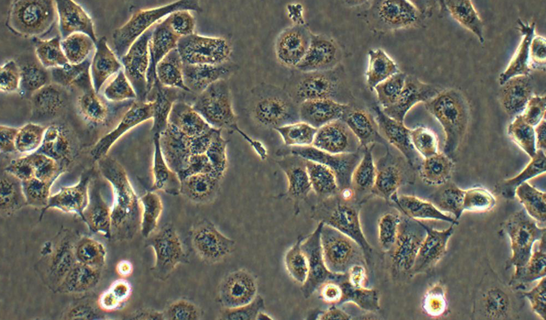 人大细胞肺癌细胞NCI-H661(STR鉴定正确)