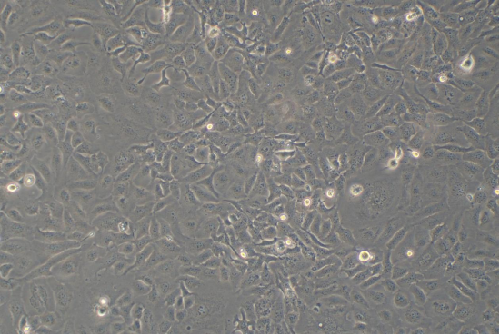 人卵巢癌细胞SKOV3 (STR鉴定正确)