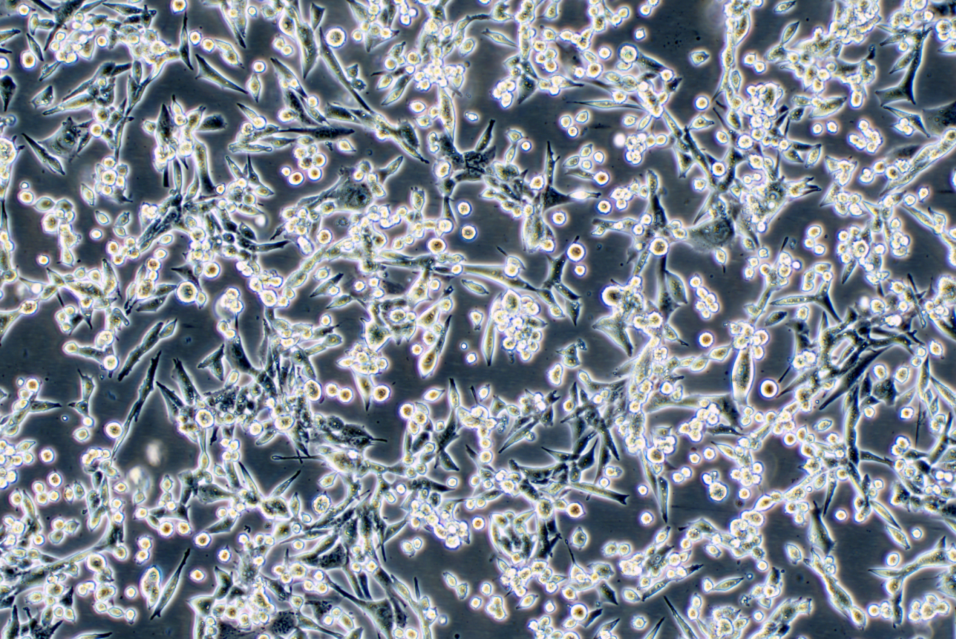 小鼠肺癌细胞带绿色荧光 LLC+GFP（种属鉴定）