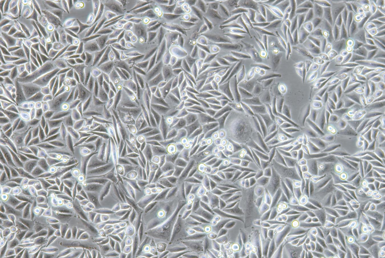 人子宫颈鳞状细胞癌细胞SiHa(STR鉴定正确)