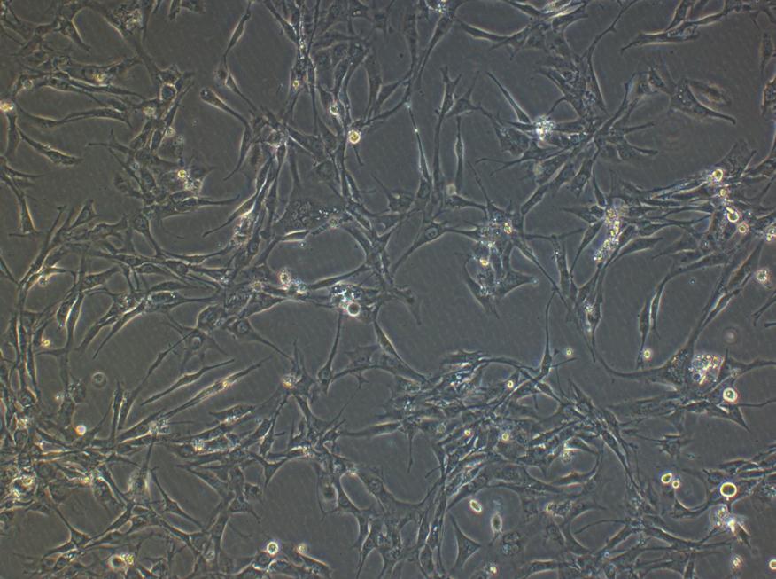 人乳腺导管癌细胞BT-549(STR鉴定正确)