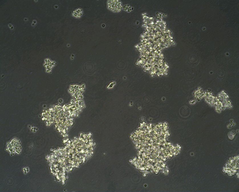 人小细胞肺癌细胞NCI-H69(STR鉴定正确)