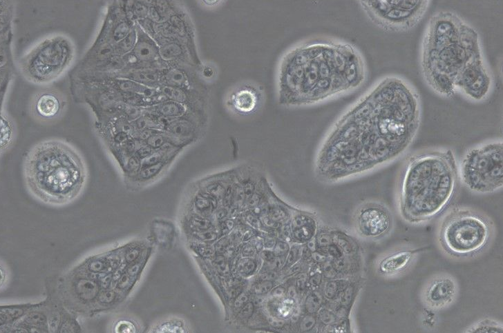 人结肠癌细胞SW1116(STR鉴定正确)