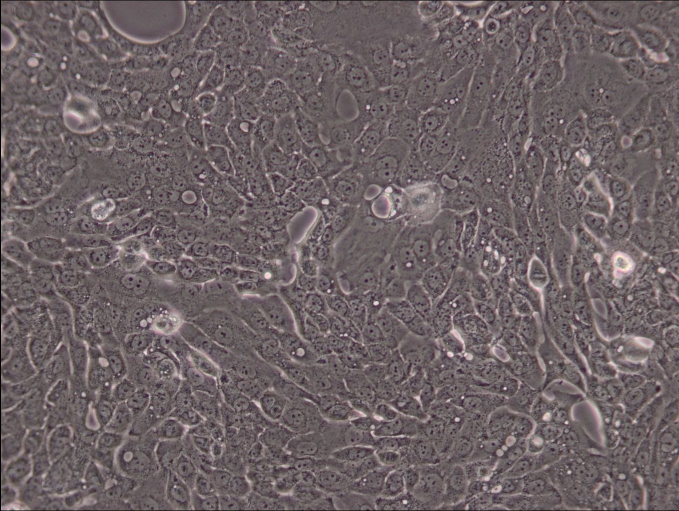 人胰腺导管癌细胞CFPAC-1(STR鉴定正确)