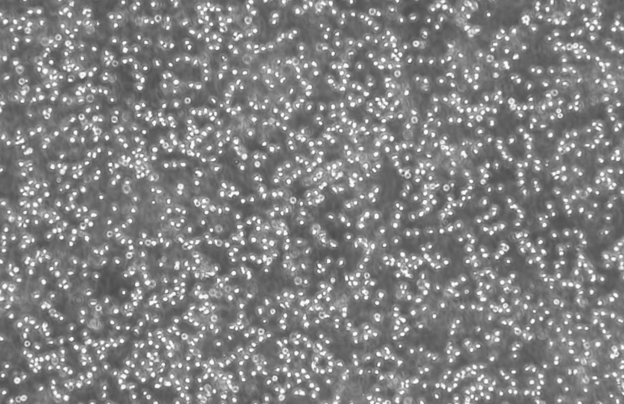 人急性髓细胞性白血病细胞OCI-AML3(STR鉴定正确)