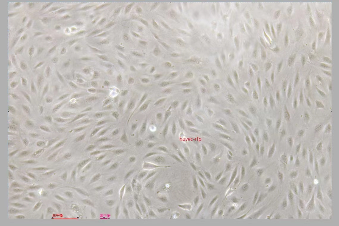 人脐静脉内皮细胞永生化HUVEC+RFP （免疫荧光鉴定）