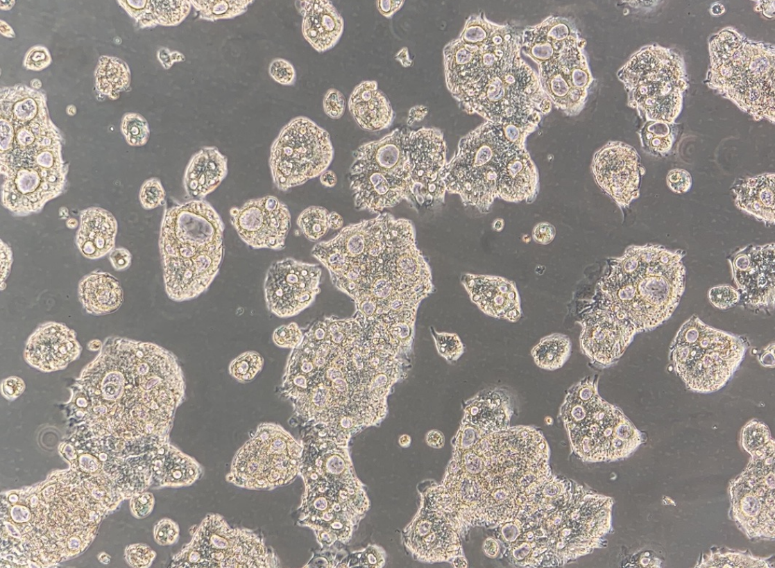 人结肠癌细胞CL-40(STR鉴定正确)