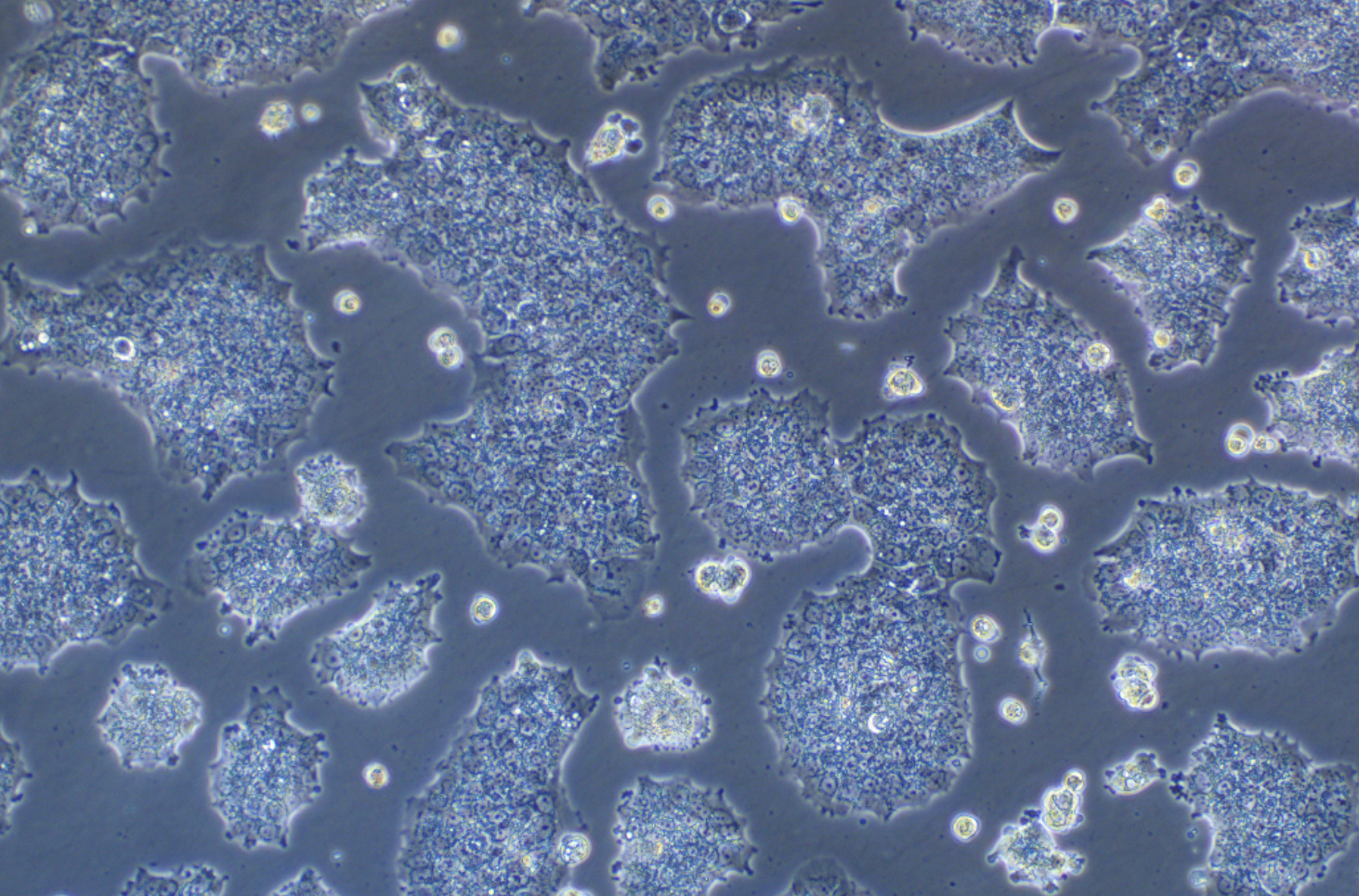 人乳腺导管癌细胞BT474(STR鉴定正确)