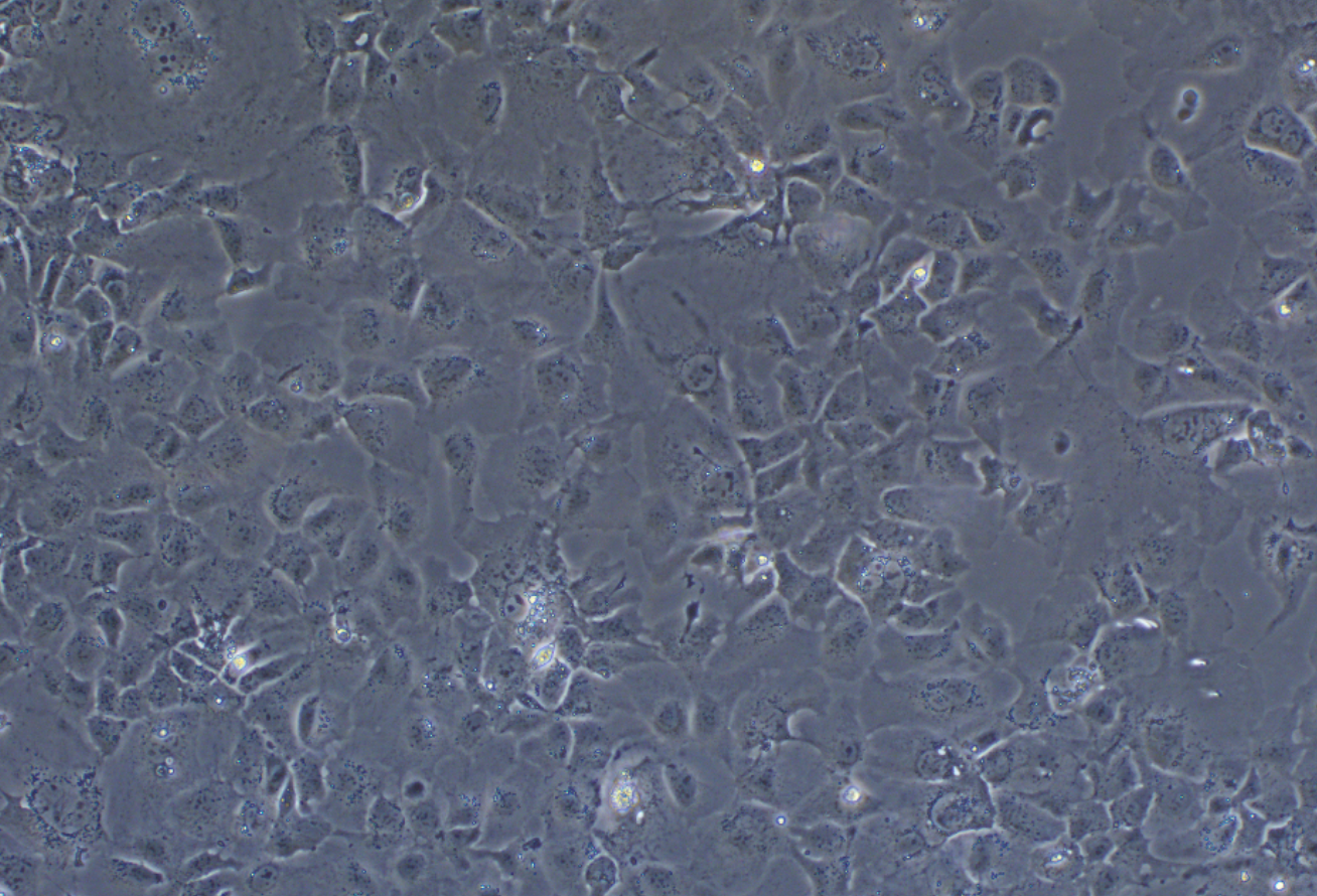 人肝癌细胞Hep3B(STR鉴定正确)