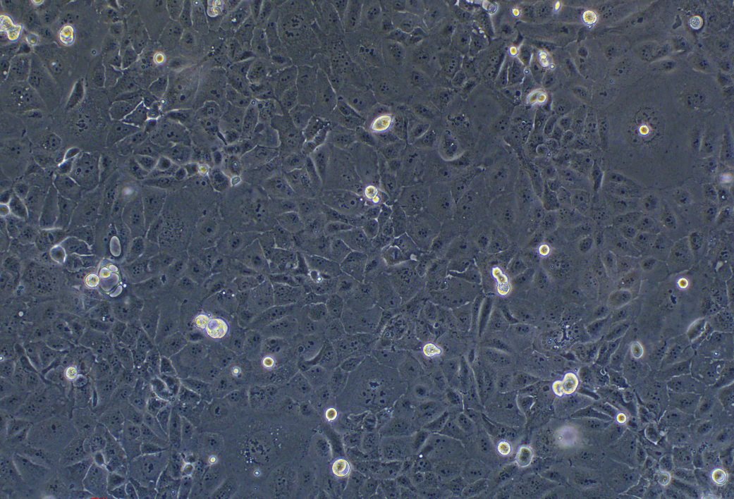 人胆管癌细胞HuCCT1(STR鉴定正确)