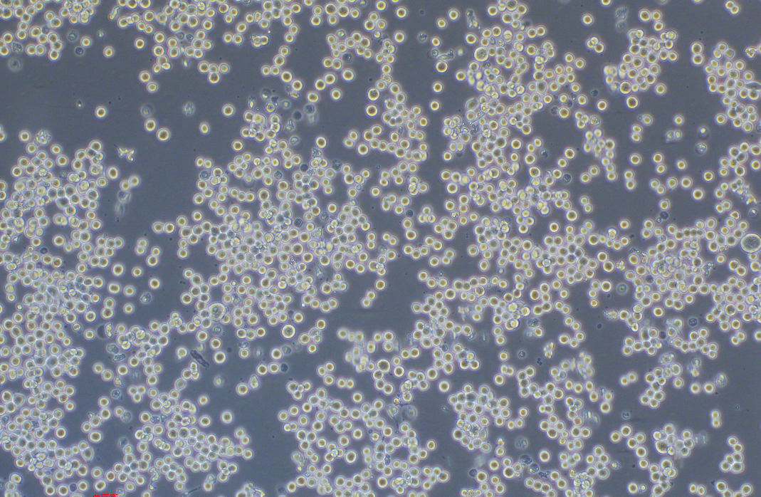 人结肠癌细胞COLO205(STR鉴定正确)