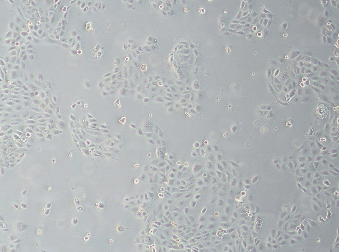 人前列腺增生细胞BPH-1  (STR鉴定正确)