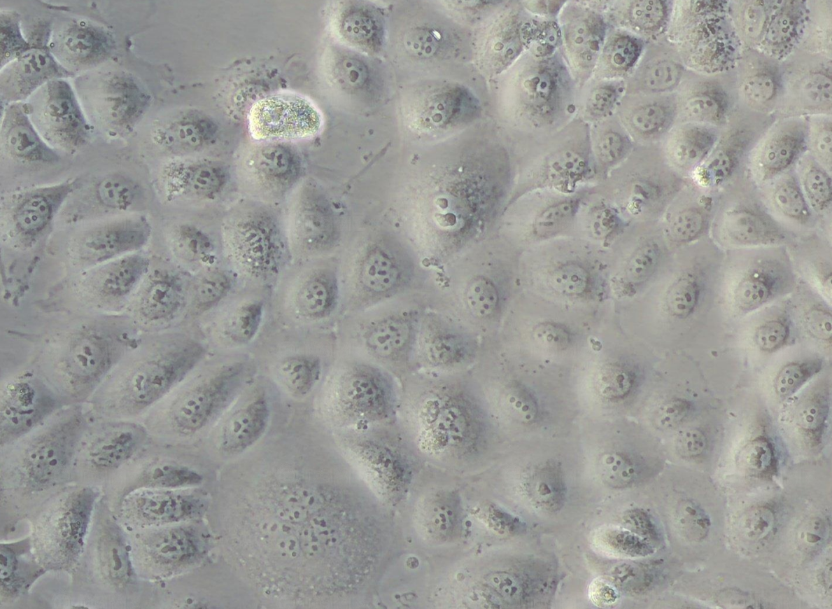 人前列腺增生细胞BPH-1  (STR鉴定正确)