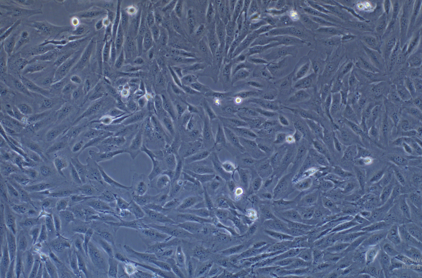 人肾透明细胞腺癌细胞786-O(STR鉴定正确)