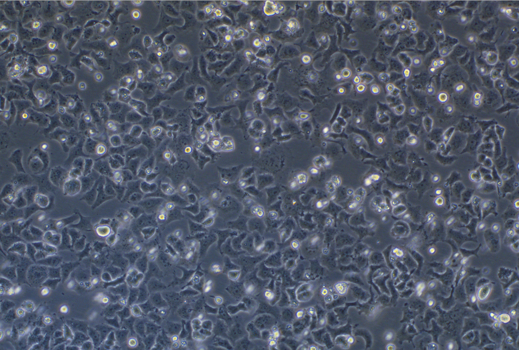 人非小细胞肺癌腺癌细胞NCI-H522 (STR鉴定正确)