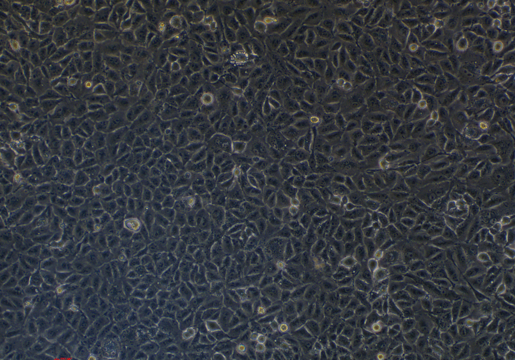 人卵巢癌顺铂耐药株SKOV3/DDP(STR鉴定正确)