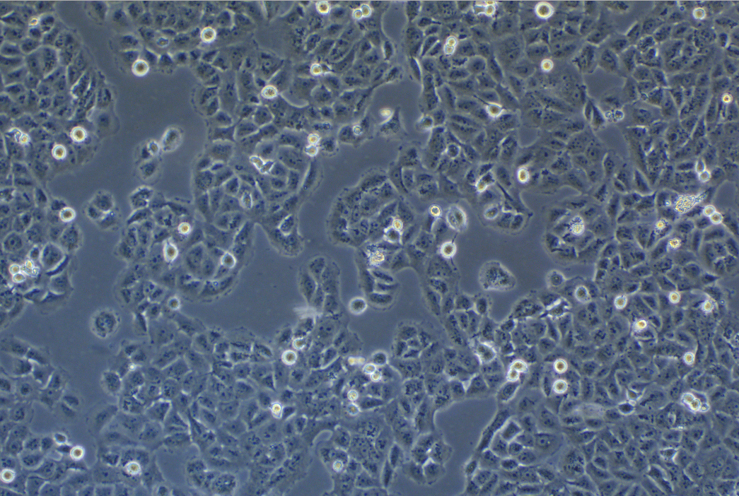 人乳腺癌阿霉素耐药细胞株MCF-7+adr (STR鉴定正确)