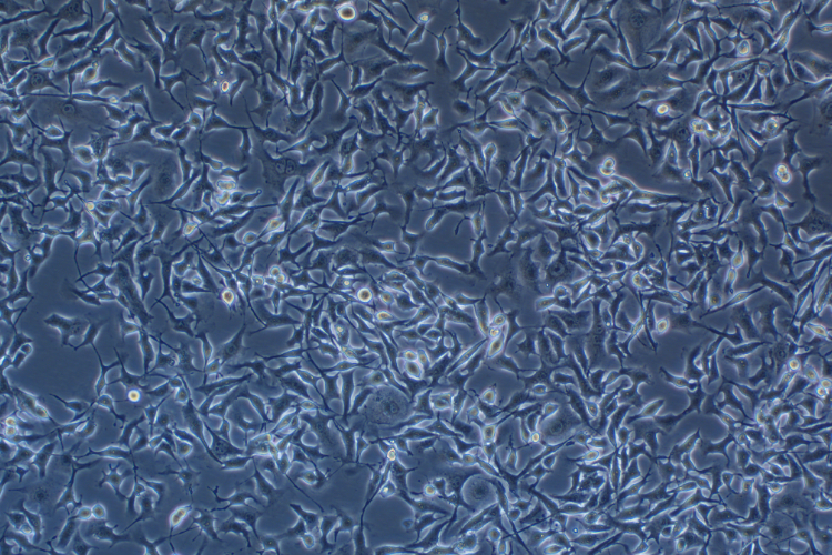 小鼠黑色素瘤细胞转染B16-F10+OVA（种属鉴定）