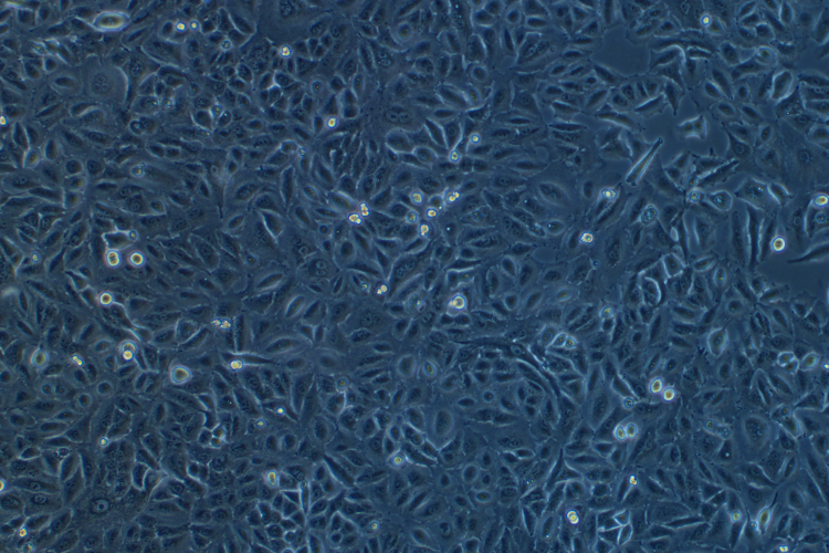 人肺癌细胞A549(STR鉴定正确)