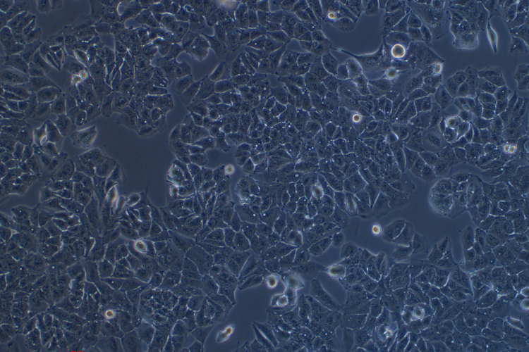 高转移人肝癌细胞MHCC97-H(STR鉴定正确)