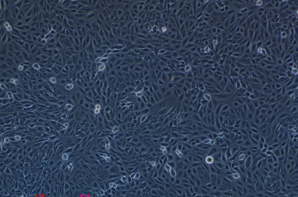 人甲状腺乳头状细胞TPC-1(STR鉴定正确)