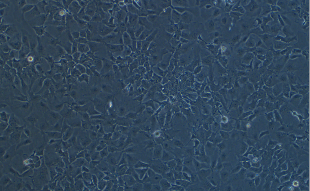 人肝癌细胞Hep3B(STR鉴定正确)