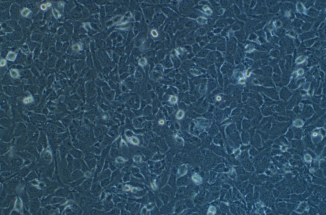 人甲状腺癌细胞KHM-5M(STR鉴定正确)