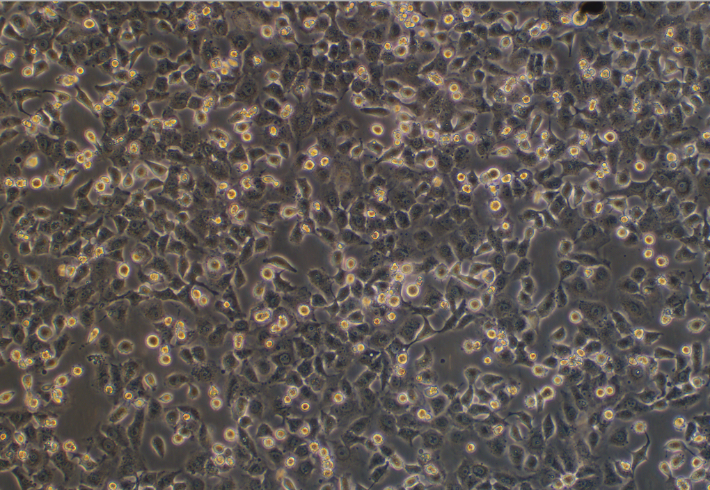 人胃癌顺铂耐药株SGC7901/DDP(STR鉴定正确)