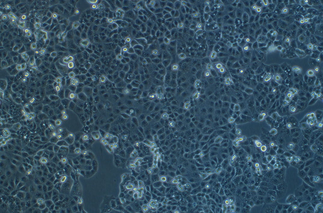 人子宫内膜癌细胞HEC-1-A(STR鉴定正确)