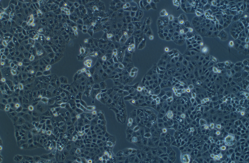 人子宫内膜癌细胞HEC-1-A(STR鉴定正确)