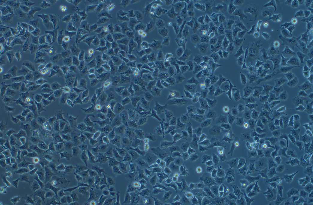 人小细胞肺癌细胞NCI-H2286(STR鉴定正确)