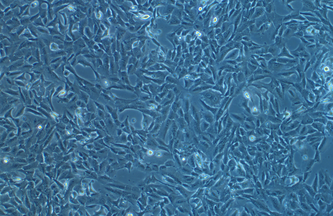 人乳腺癌细胞SUM159PT(STR鉴定正确)