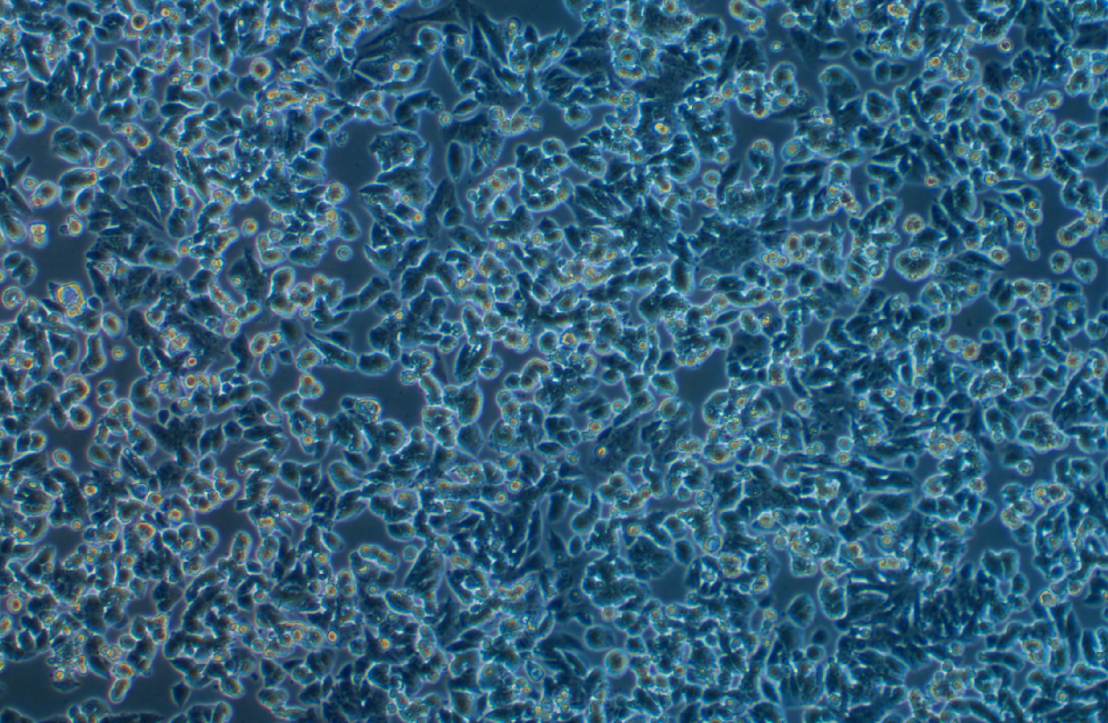 人小细胞肺癌NCI-H1048(STR鉴定正确)