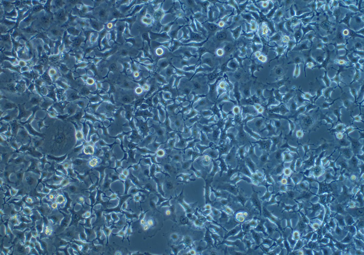 人肺鳞癌细胞HCC1588 (STR鉴定正确)