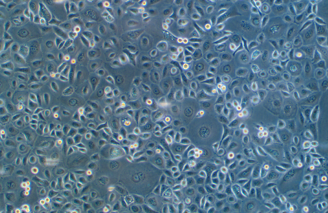 人非小细胞肺癌奥希替尼耐药株PC-9+Osimertinib