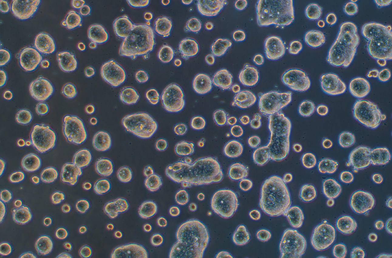 人结肠癌细胞SW403(STR鉴定正确)