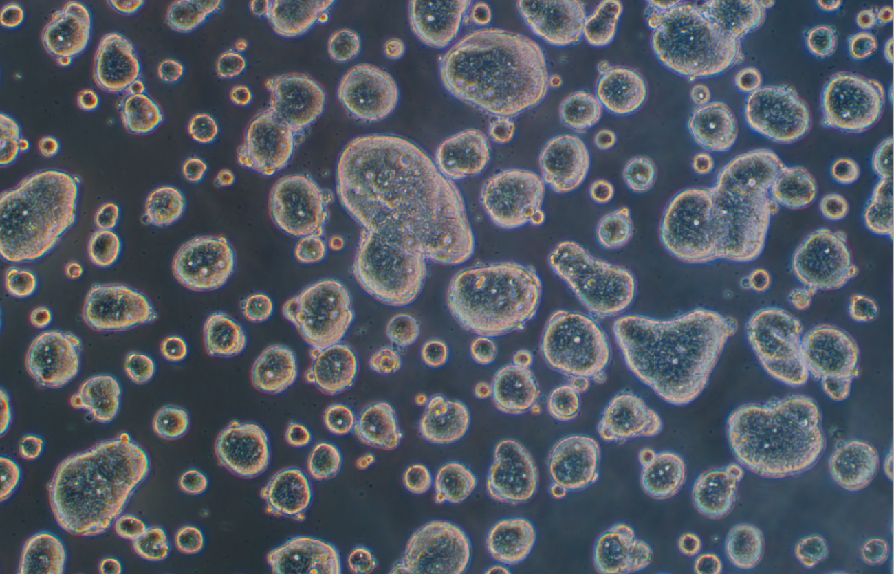 人结肠癌细胞SW403(STR鉴定正确)