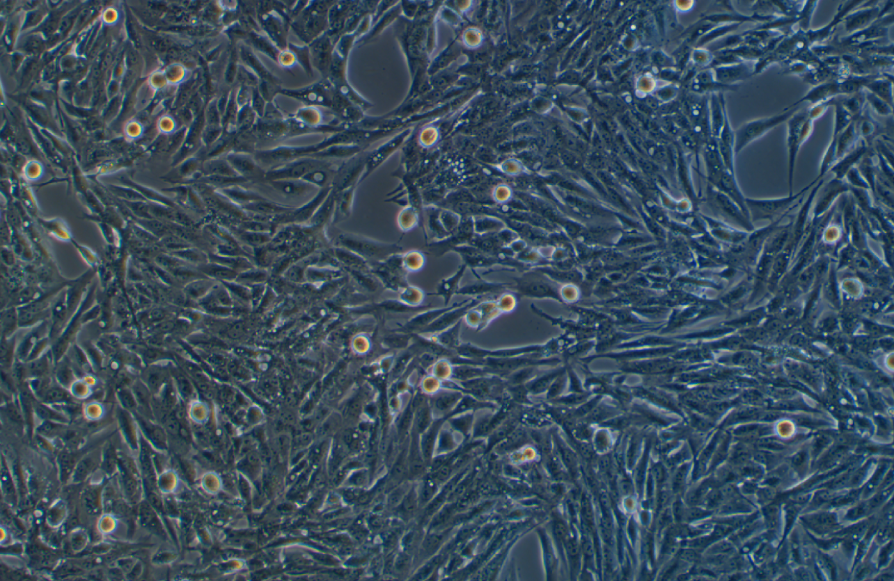 人胃粘膜细胞GES-1(STR鉴定正确)