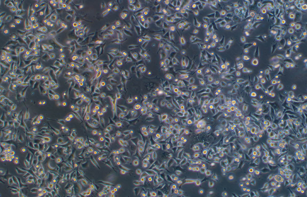 人胃癌细胞SNU601(STR鉴定正确)