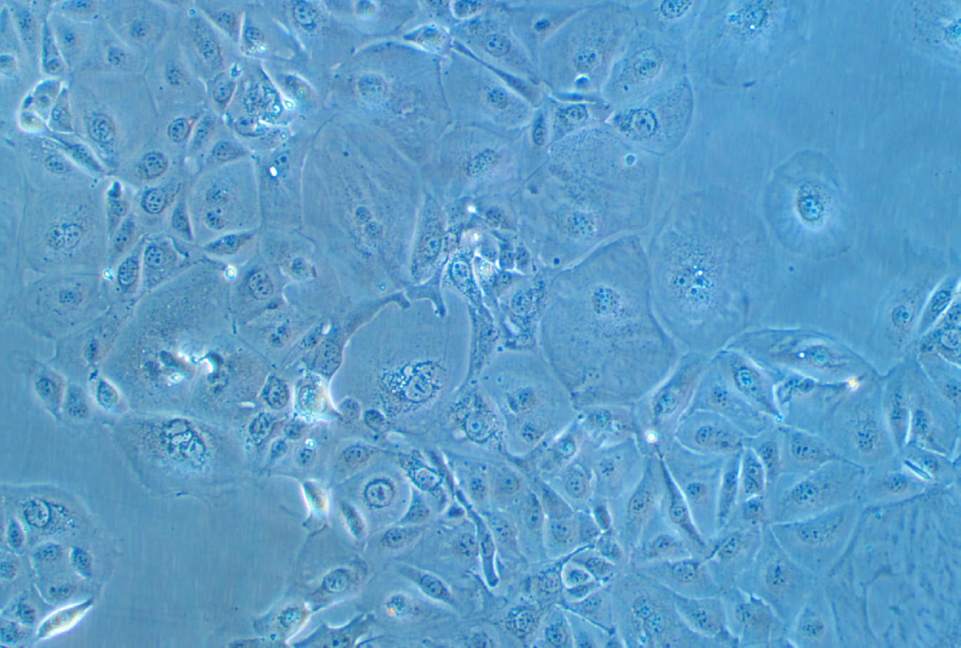 人肺腺癌细胞NCI-H3255(STR鉴定正确)