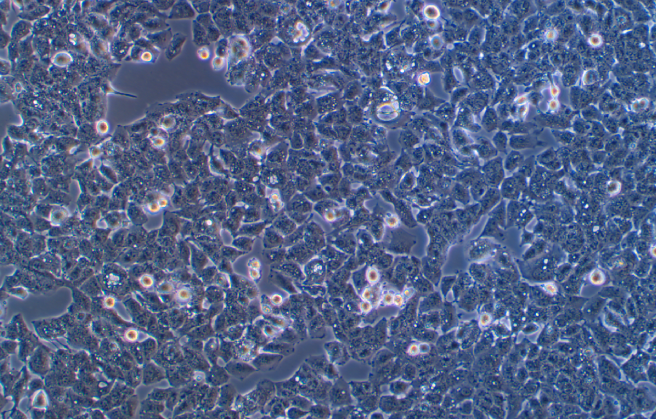 高转移人肝癌细胞带荧光素酶MHCC97-H+LUC（STR鉴定）