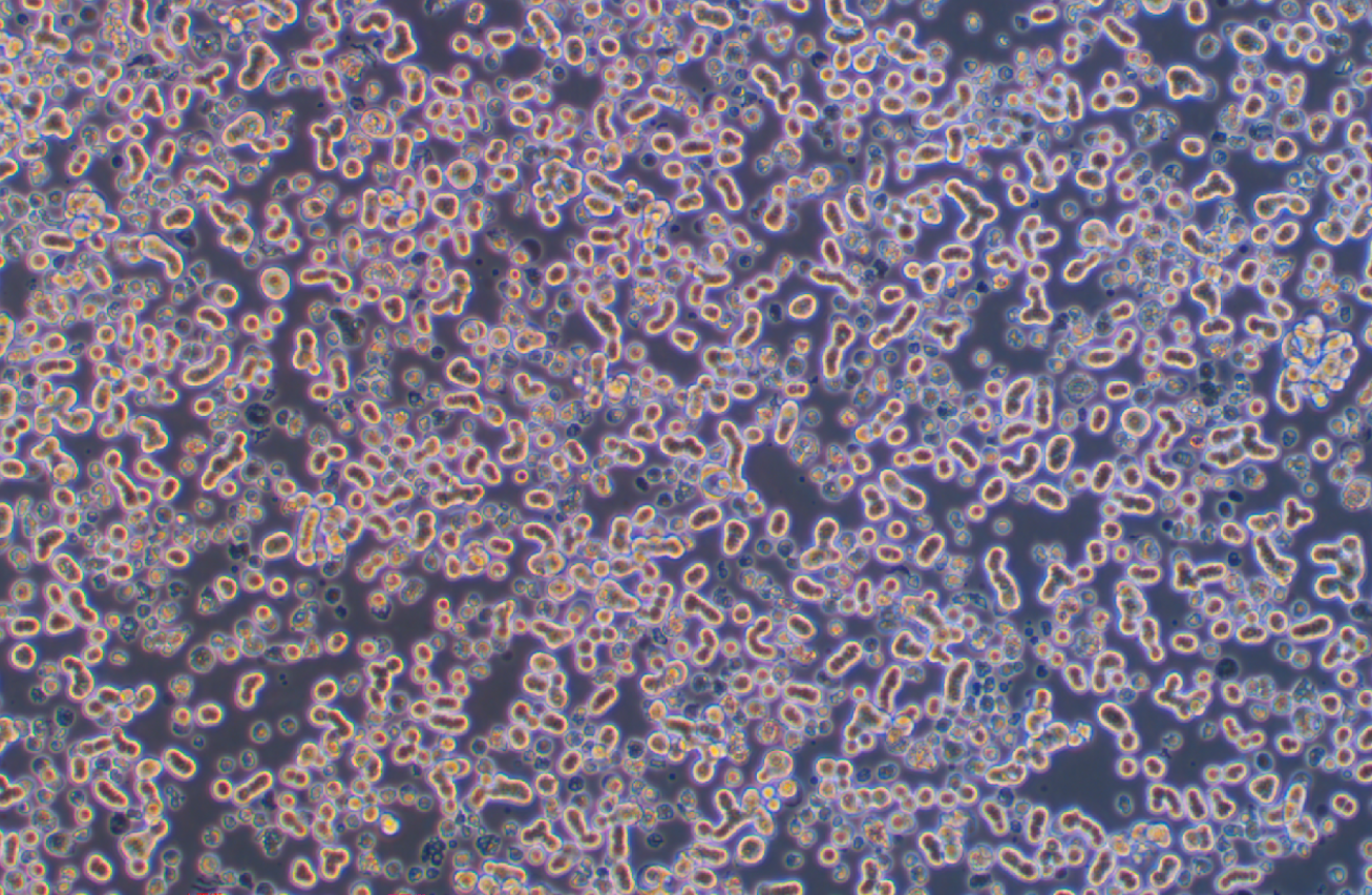 人乳腺上皮细胞DU4475(STR鉴定正确)