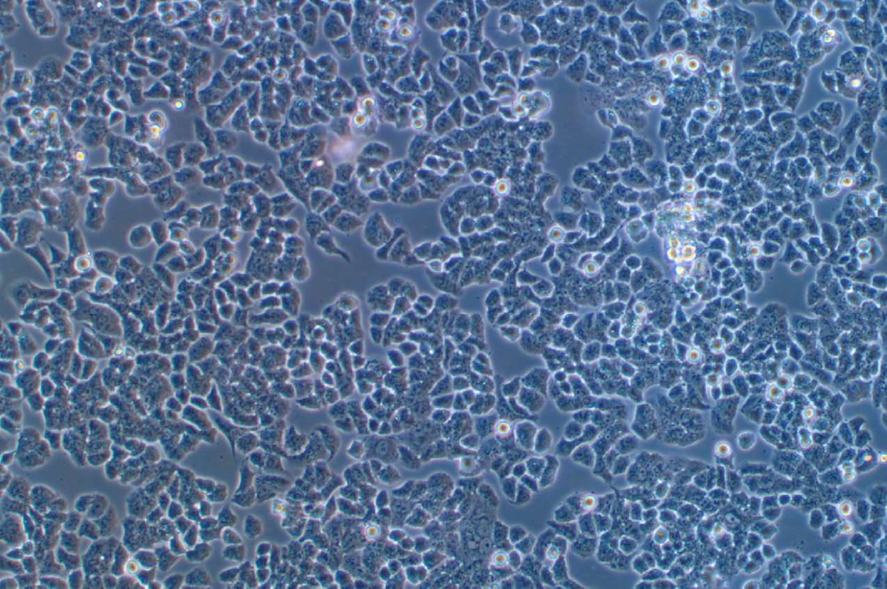 人卵巢癌顺铂耐药株A2780+DDP(STR鉴定正确)