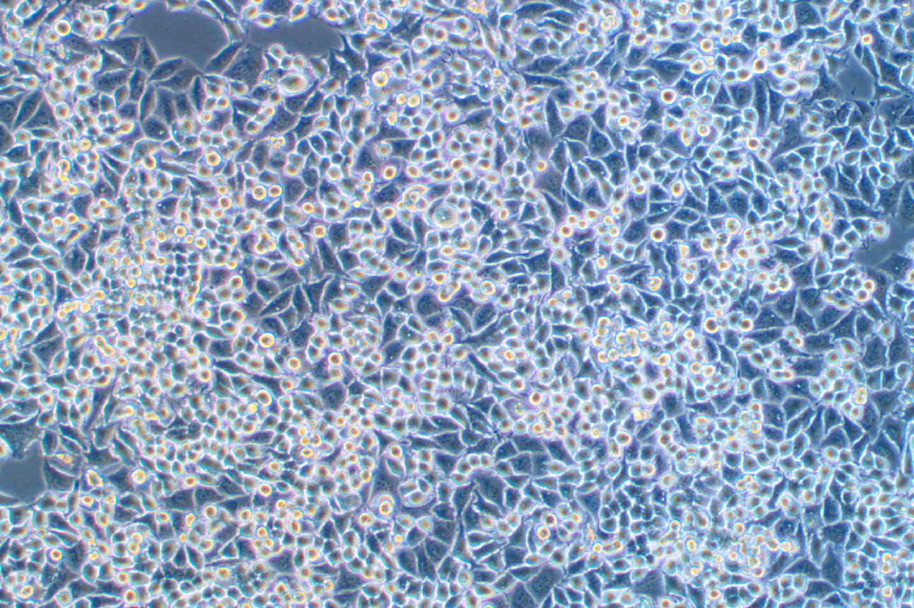  人胰腺癌细胞KP4(STR鉴定正确)