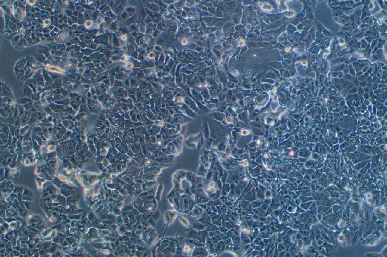 人乳腺癌阿霉素耐药细胞株MCF-7+adr (STR鉴定正确)