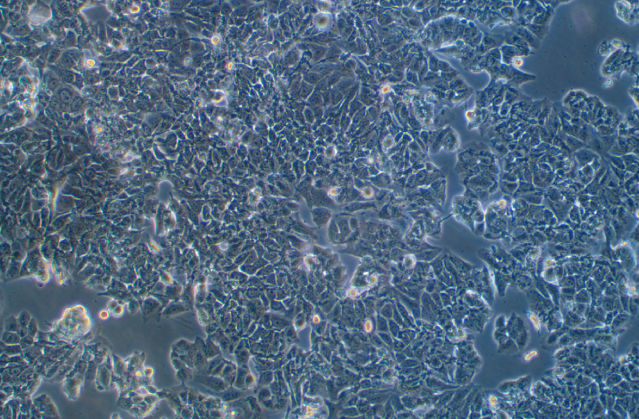 人乳腺癌阿霉素耐药细胞株MCF-7+adr (STR鉴定正确)