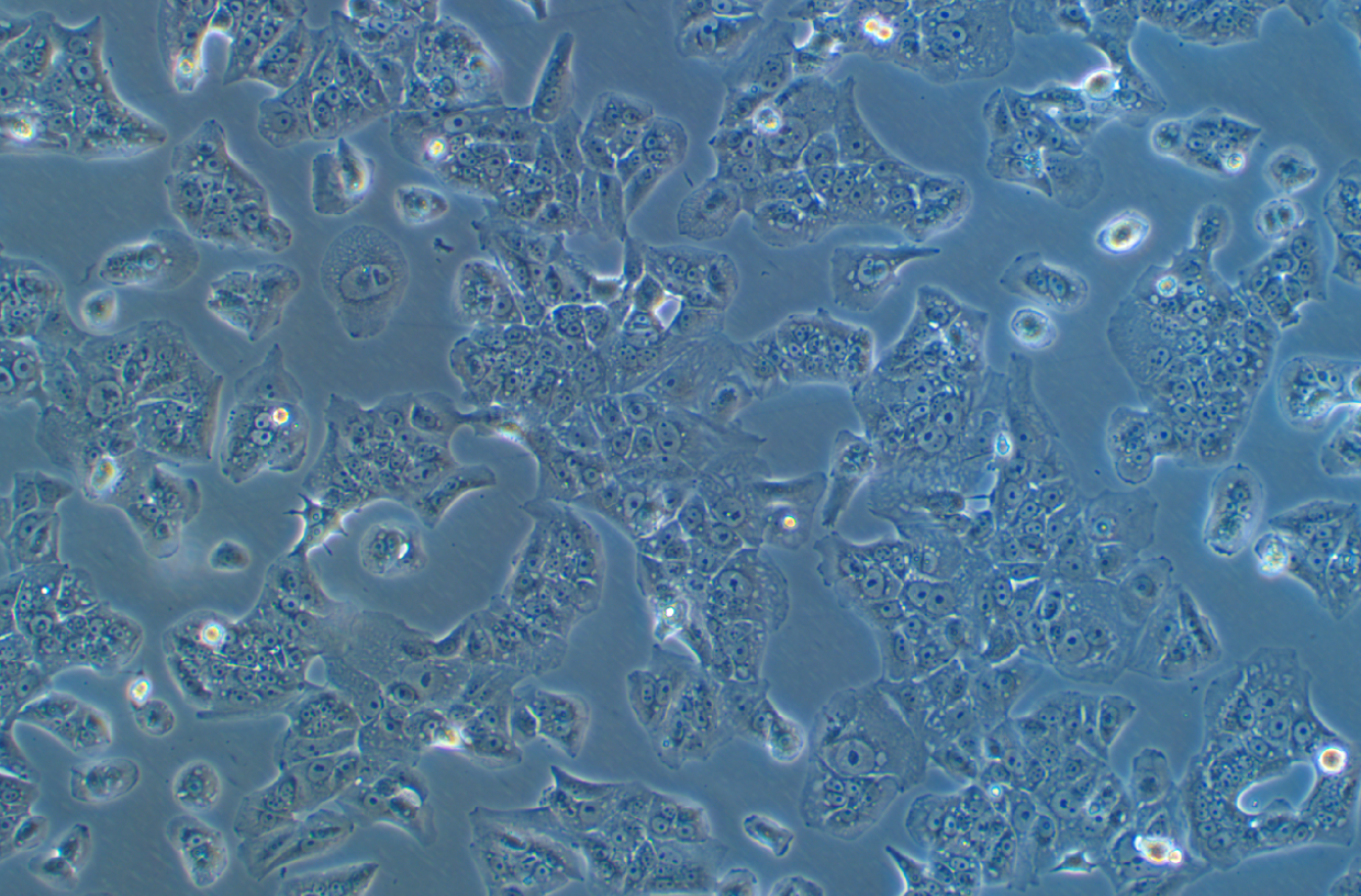 人肝癌细胞SNU368(STR鉴定正确)