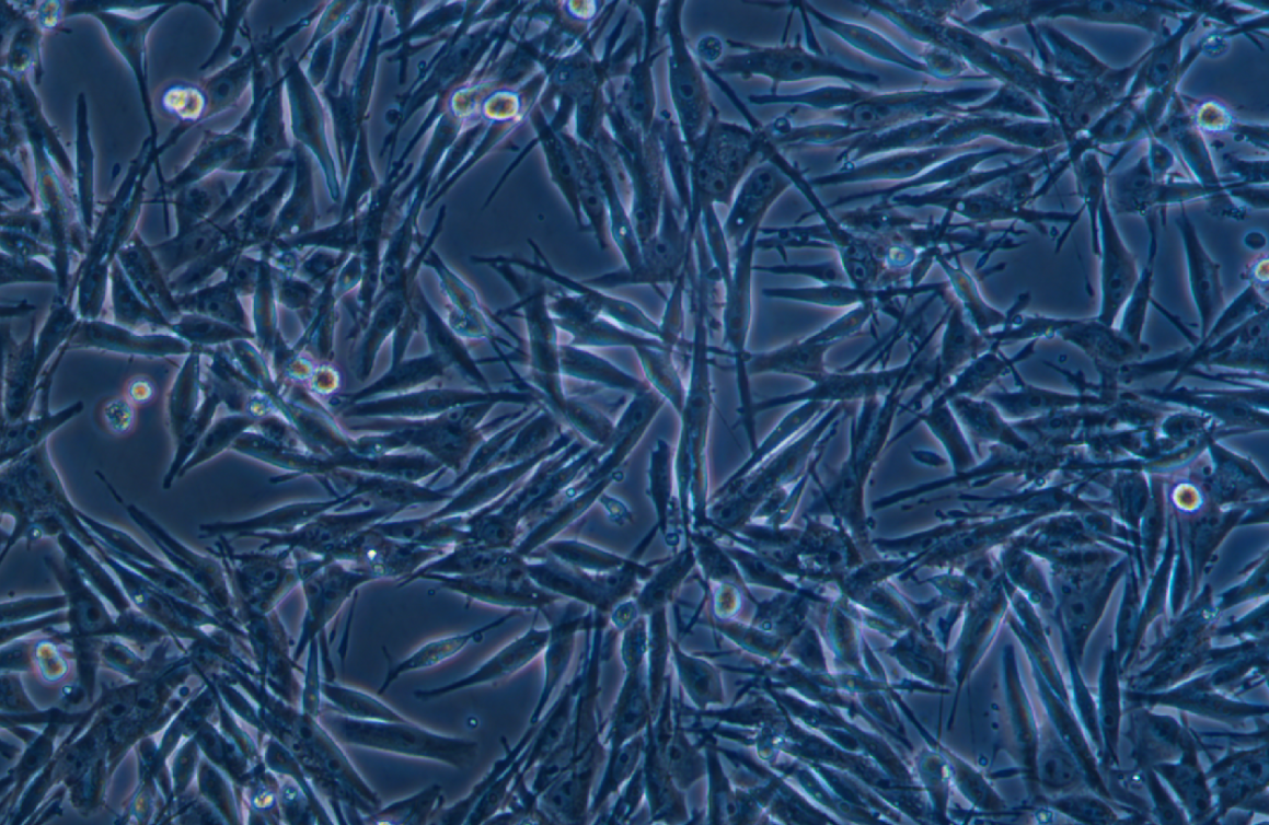 人恶性黑色素瘤细胞MeWo(STR鉴定正确)