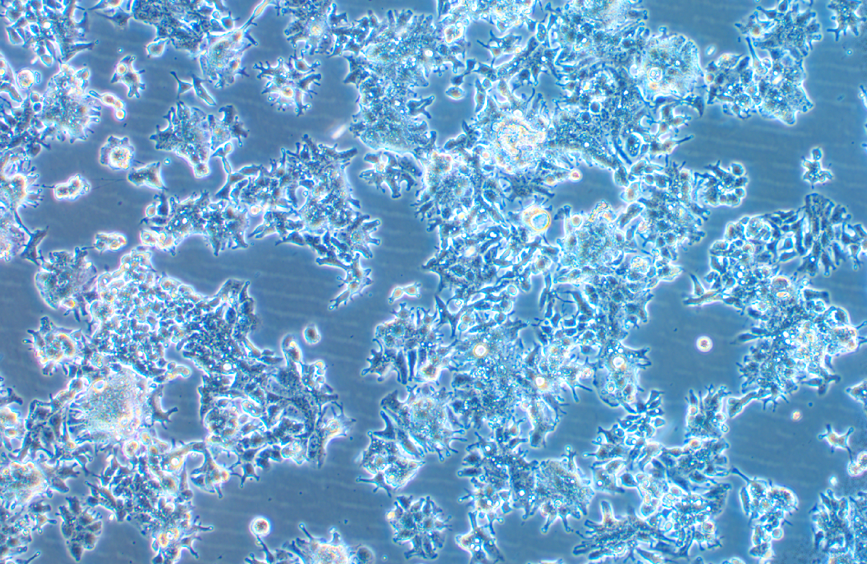 人结肠腺癌细胞LS1034 (STR鉴定正确)