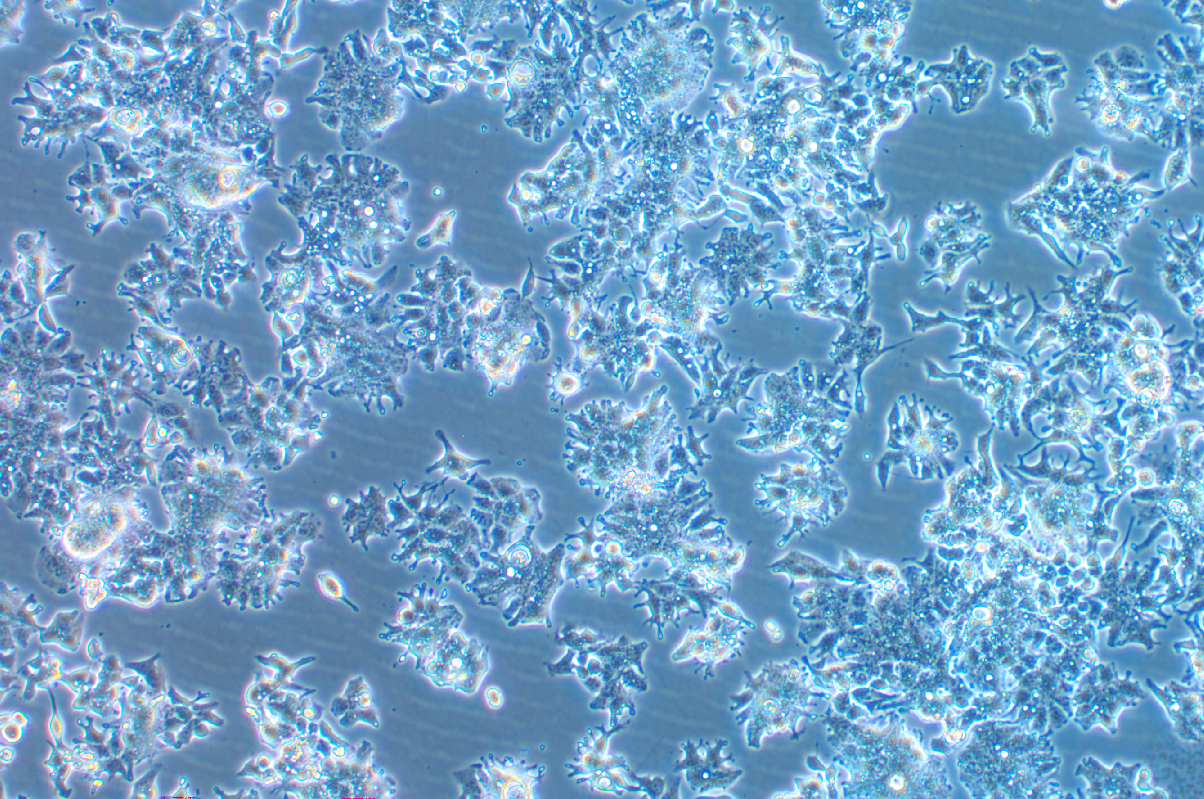 人结肠腺癌细胞LS1034 (STR鉴定正确)